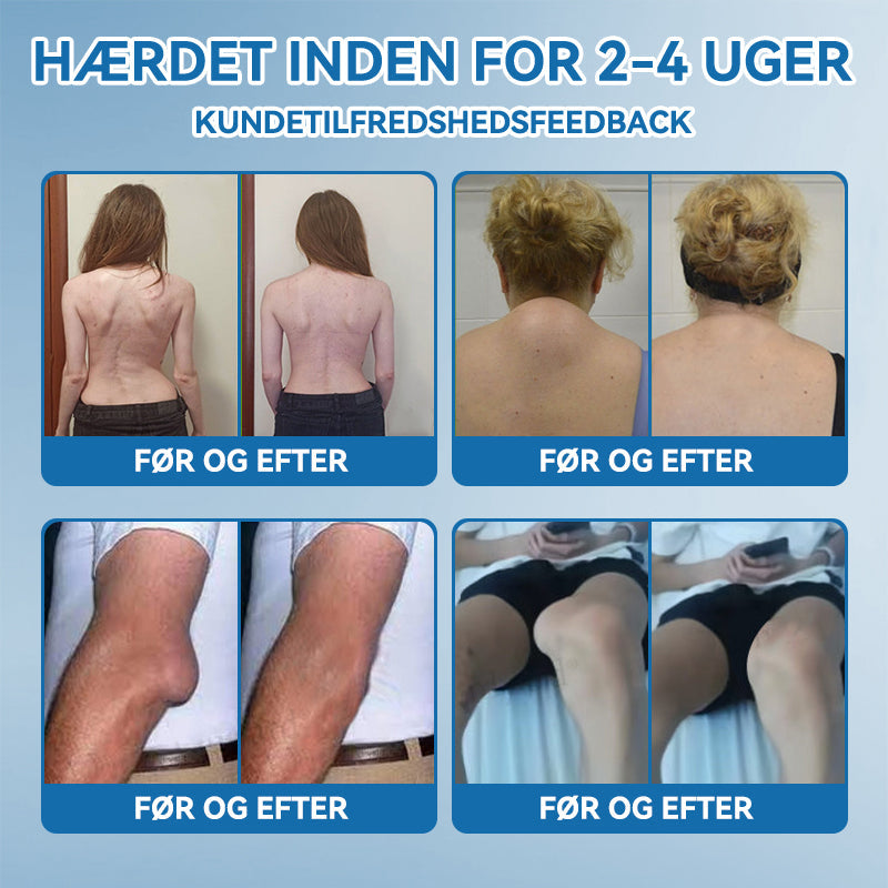 𝐎𝐟𝐟𝐢𝐜𝐢𝐞𝐥 𝐛𝐮𝐭𝐢𝐤 | 𝖯𝗂𝖼𝗱𝗼® 🏥𝐁𝐏𝐂-𝟏𝟓𝟕 𝐅æ𝐥𝐥𝐞𝐬 𝐇𝐞𝐥𝐞𝐧𝐝𝐞 𝐂𝐫𝐞𝐦𝐞🦴Behandler gigt, neuropati, reumatisme, sportsskader og mere👍