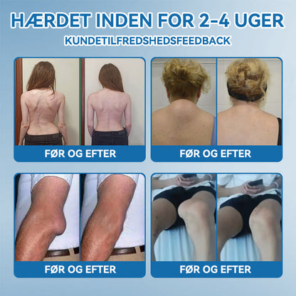 𝐎𝐟𝐟𝐢𝐜𝐢𝐞𝐥 𝐛𝐮𝐭𝐢𝐤 | 𝖯𝗂𝖼𝗱𝗼® 🏥𝐁𝐏𝐂-𝟏𝟓𝟕 𝐅æ𝐥𝐥𝐞𝐬 𝐇𝐞𝐥𝐞𝐧𝐝𝐞 𝐂𝐫𝐞𝐦𝐞🦴Behandler gigt, neuropati, reumatisme, sportsskader og mere👍