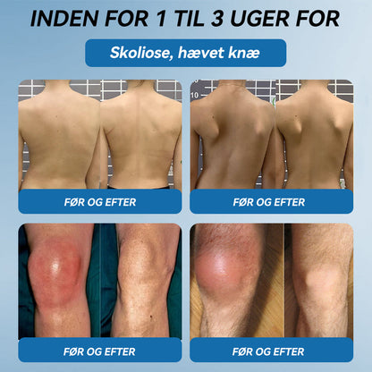 𝐎𝐟𝐟𝐢𝐜𝐢𝐞𝐥 𝐛𝐮𝐭𝐢𝐤 | 𝖯𝗂𝖼𝗱𝗼® 🏥𝐁𝐏𝐂-𝟏𝟓𝟕 𝐅æ𝐥𝐥𝐞𝐬 𝐇𝐞𝐥𝐞𝐧𝐝𝐞 𝐂𝐫𝐞𝐦𝐞🦴Behandler gigt, neuropati, reumatisme, sportsskader og mere👍