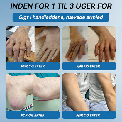 𝐎𝐟𝐟𝐢𝐜𝐢𝐞𝐥 𝐛𝐮𝐭𝐢𝐤 | 𝖯𝗂𝖼𝗱𝗼® 🏥𝐁𝐏𝐂-𝟏𝟓𝟕 𝐅æ𝐥𝐥𝐞𝐬 𝐇𝐞𝐥𝐞𝐧𝐝𝐞 𝐂𝐫𝐞𝐦𝐞🦴Behandler gigt, neuropati, reumatisme, sportsskader og mere👍