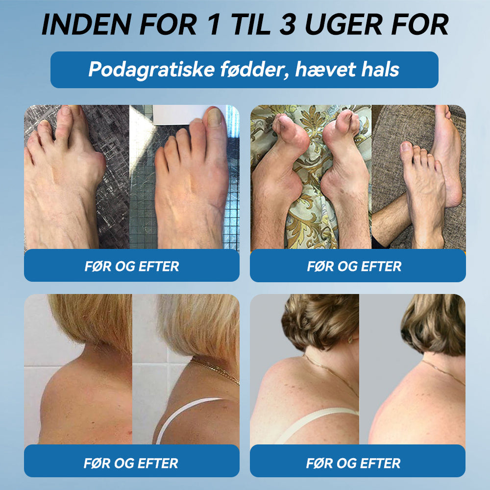 𝐎𝐟𝐟𝐢𝐜𝐢𝐞𝐥 𝐛𝐮𝐭𝐢𝐤 | 𝖯𝗂𝖼𝗱𝗼® 🏥𝐁𝐏𝐂-𝟏𝟓𝟕 𝐅æ𝐥𝐥𝐞𝐬 𝐇𝐞𝐥𝐞𝐧𝐝𝐞 𝐂𝐫𝐞𝐦𝐞🦴Behandler gigt, neuropati, reumatisme, sportsskader og mere👍